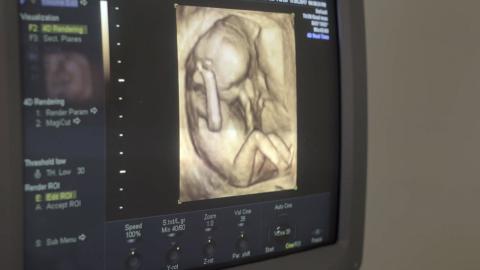 3dultrasoundunborn_hdv.jpg